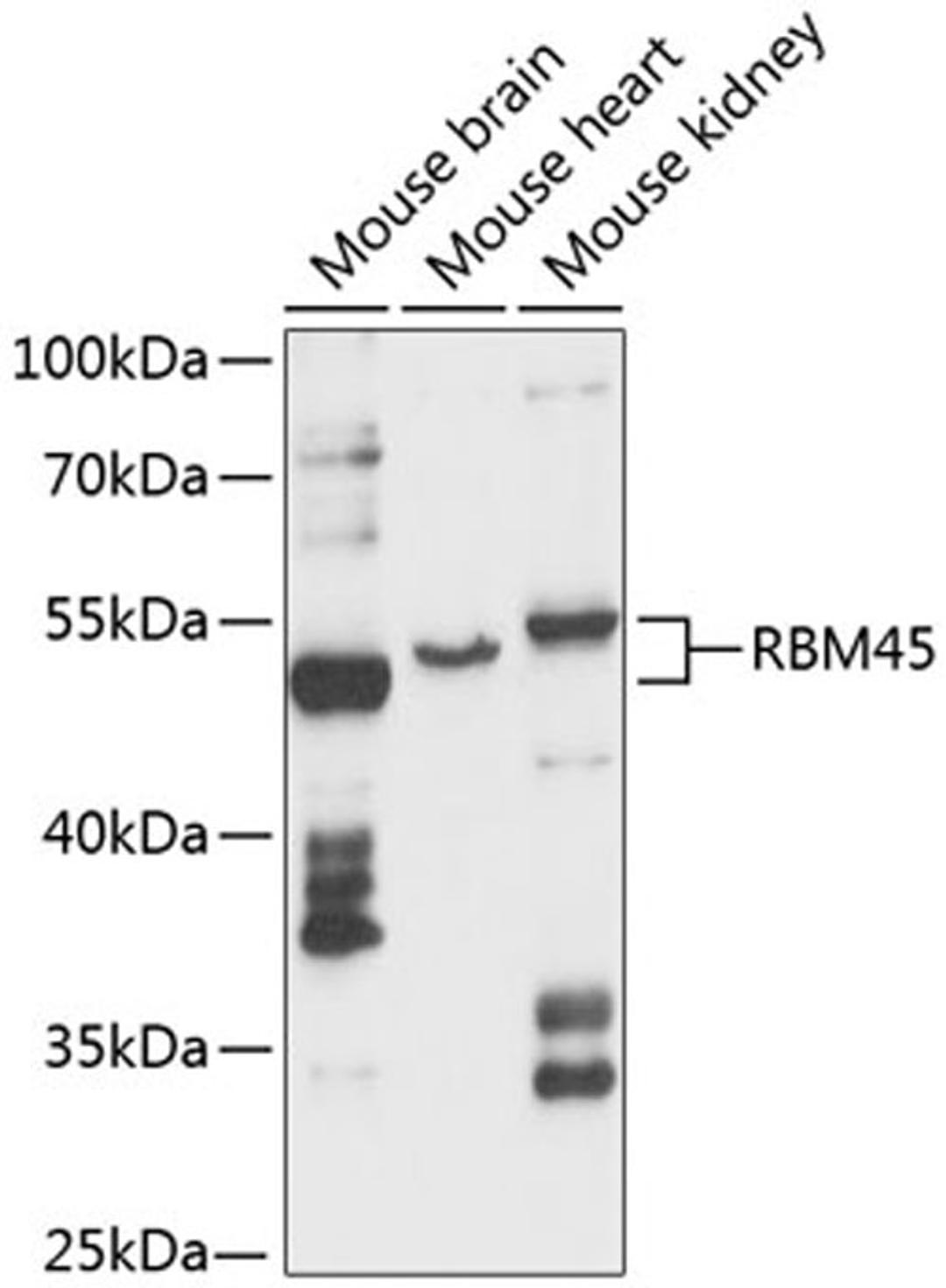 Western blot - RBM45 antibody (A13843)