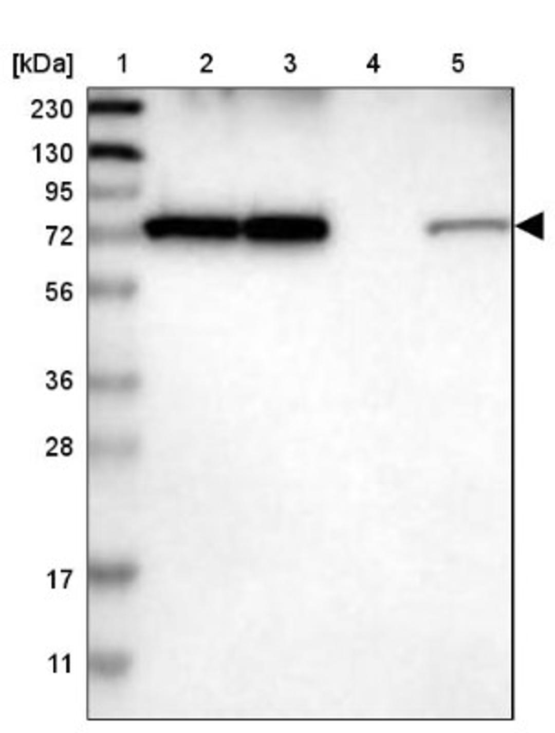 Western Blot: DDX41 Antibody [NBP1-89297] - Lane 1: Marker [kDa] 230, 130, 95, 72, 56, 36, 28, 17, 11<br/>Lane 2: Human cell line RT-4<br/>Lane 3: Human cell line U-251MG sp<br/>Lane 4: Human plasma (IgG/HSA depleted)<br/>Lane 5: Human liver tissue