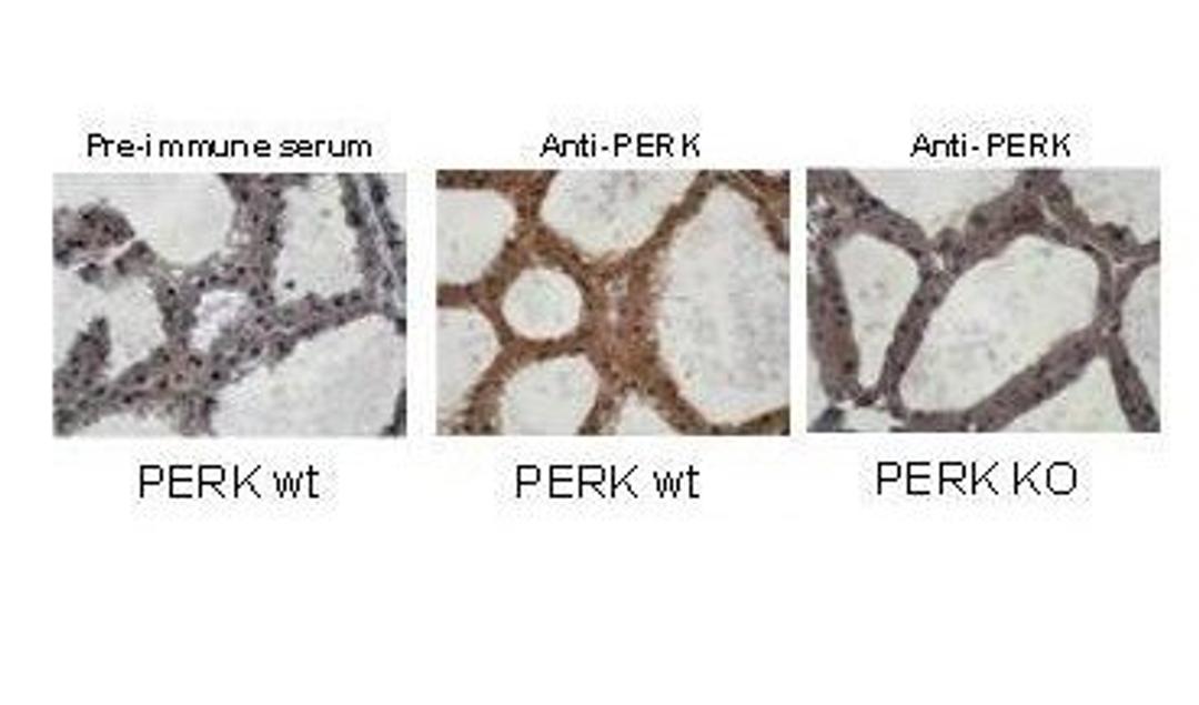 Immunohistochemical staining of mouse mammary tissue using PERK antibody