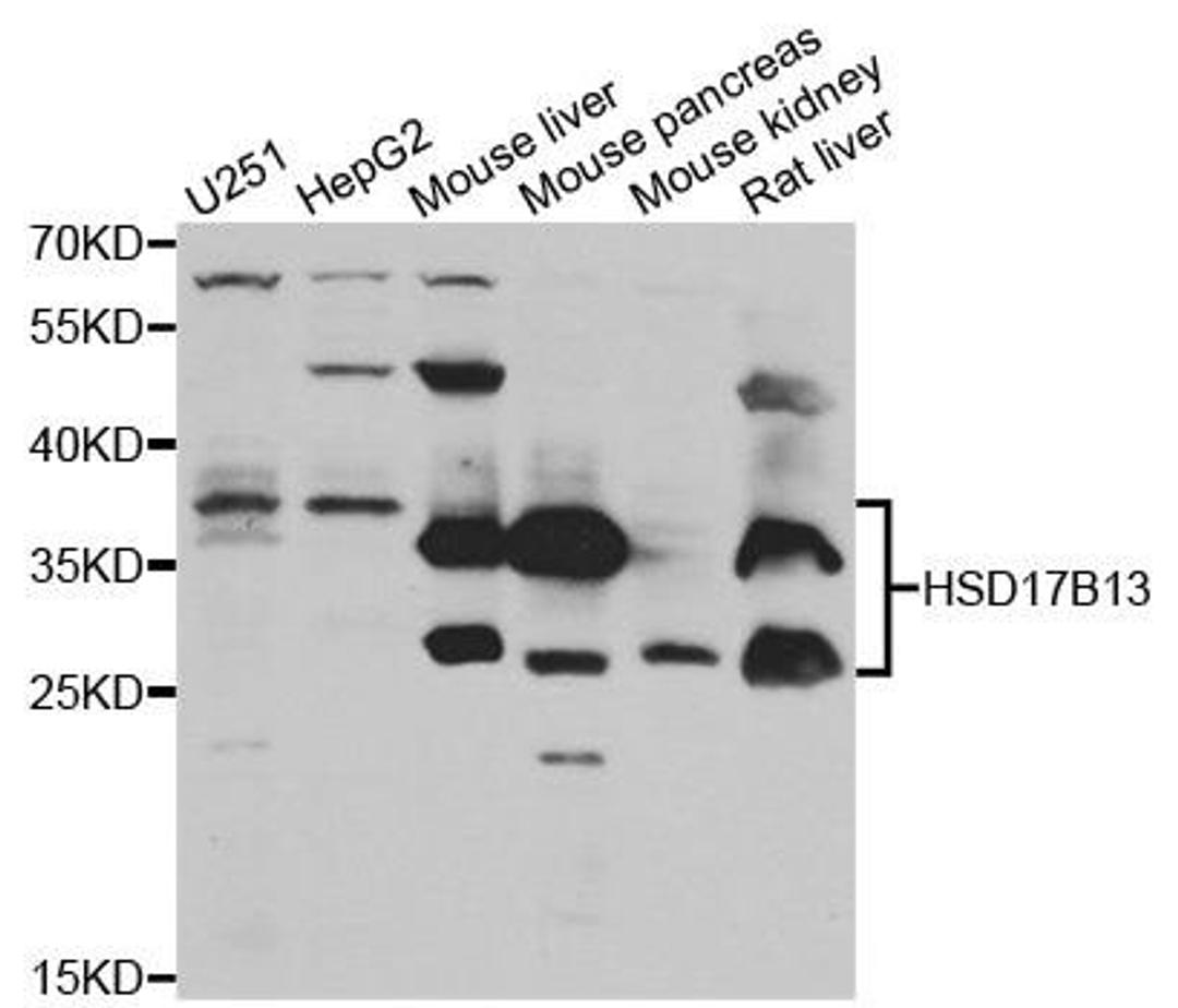 Western blot analysis of extracts of various cell lines using HSD17B13 antibody