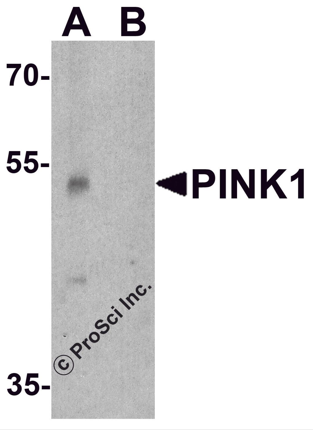 Western blot analysis of PINK1 in A431 cell lysate with PINK1 antibody at 1 μg/ml in (A) the absence and (B) the presence of blocking peptide.