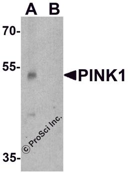 Western blot analysis of PINK1 in A431 cell lysate with PINK1 antibody at 1 μg/ml in (A) the absence and (B) the presence of blocking peptide.