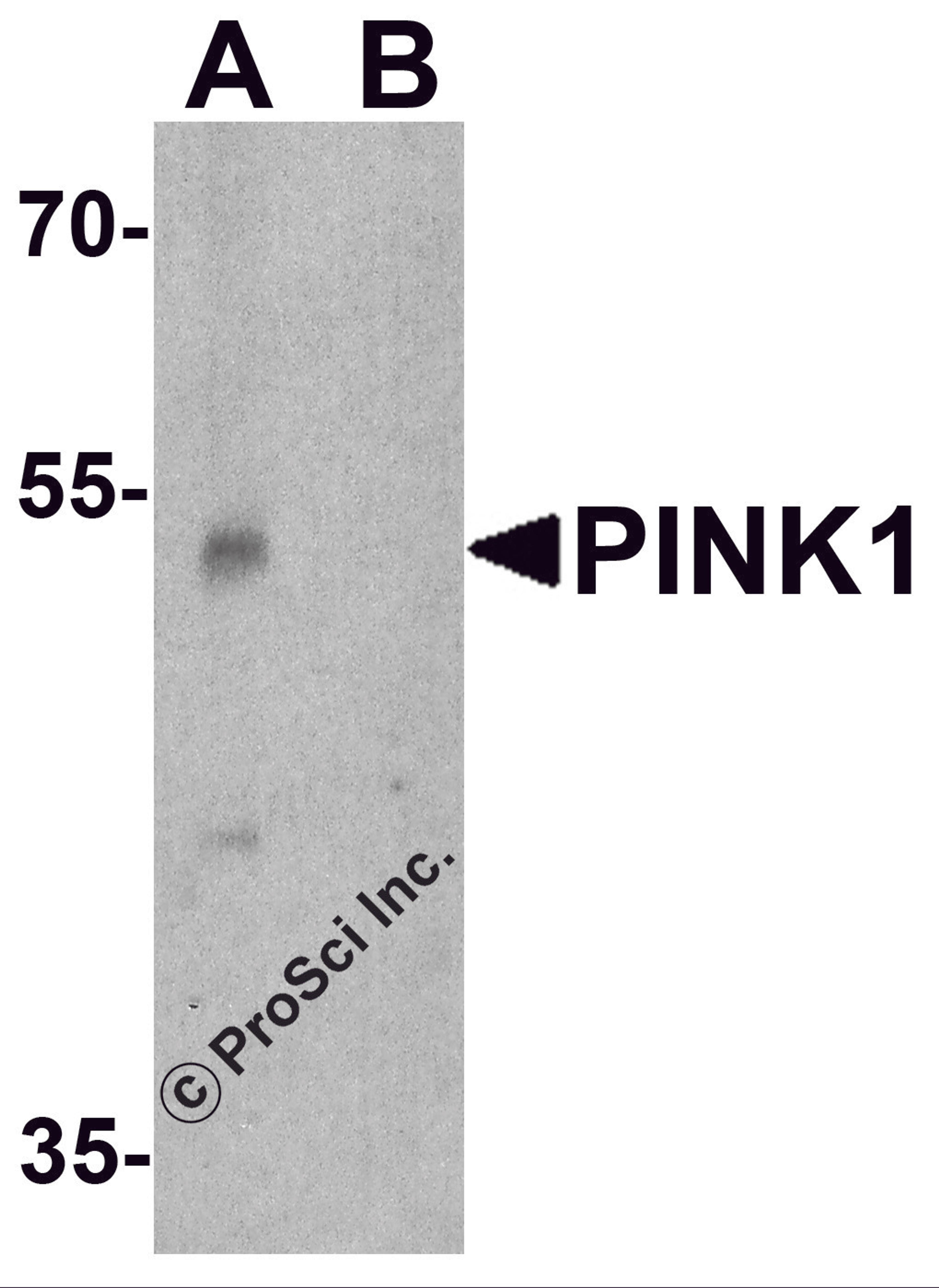 Western blot analysis of PINK1 in A431 cell lysate with PINK1 antibody at 1 μg/ml in (A) the absence and (B) the presence of blocking peptide.