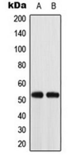 Western blot analysis of K562 (Lane 1), HT29 (Lane 2) whole cell lysates using ACOT2 antibody