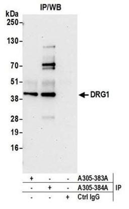 Detection of human DRG1 by western blot of immunoprecipitates.