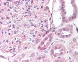 Immunohistochemistry staining of ST14 in kidney (formalin-fixed paraffin embedded) tissue using ST14 Antibody.