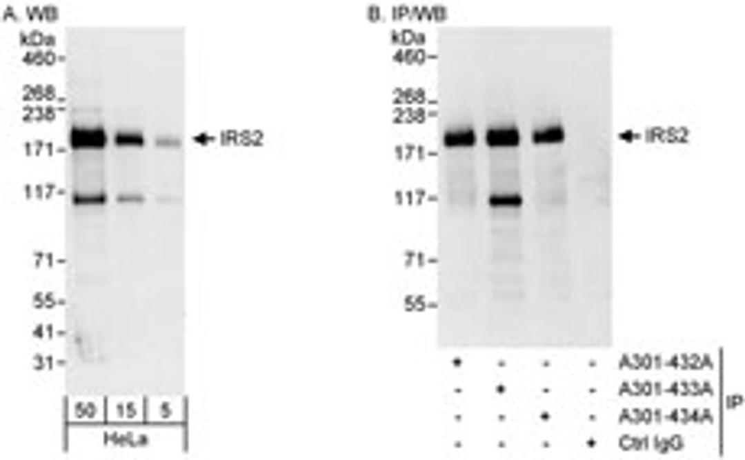 Detection of human IRS2 by western blot and immunoprecipitation.