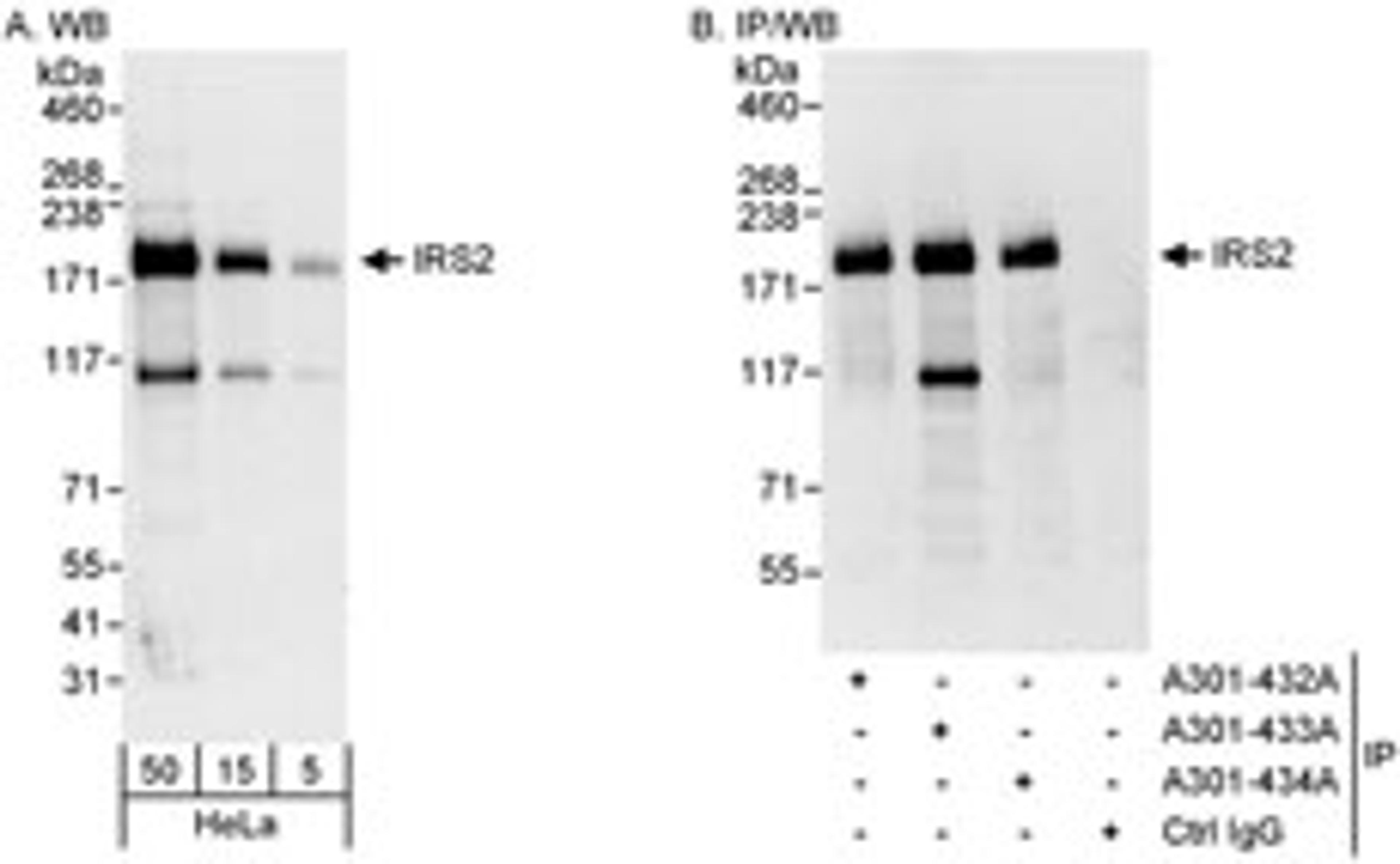 Detection of human IRS2 by western blot and immunoprecipitation.