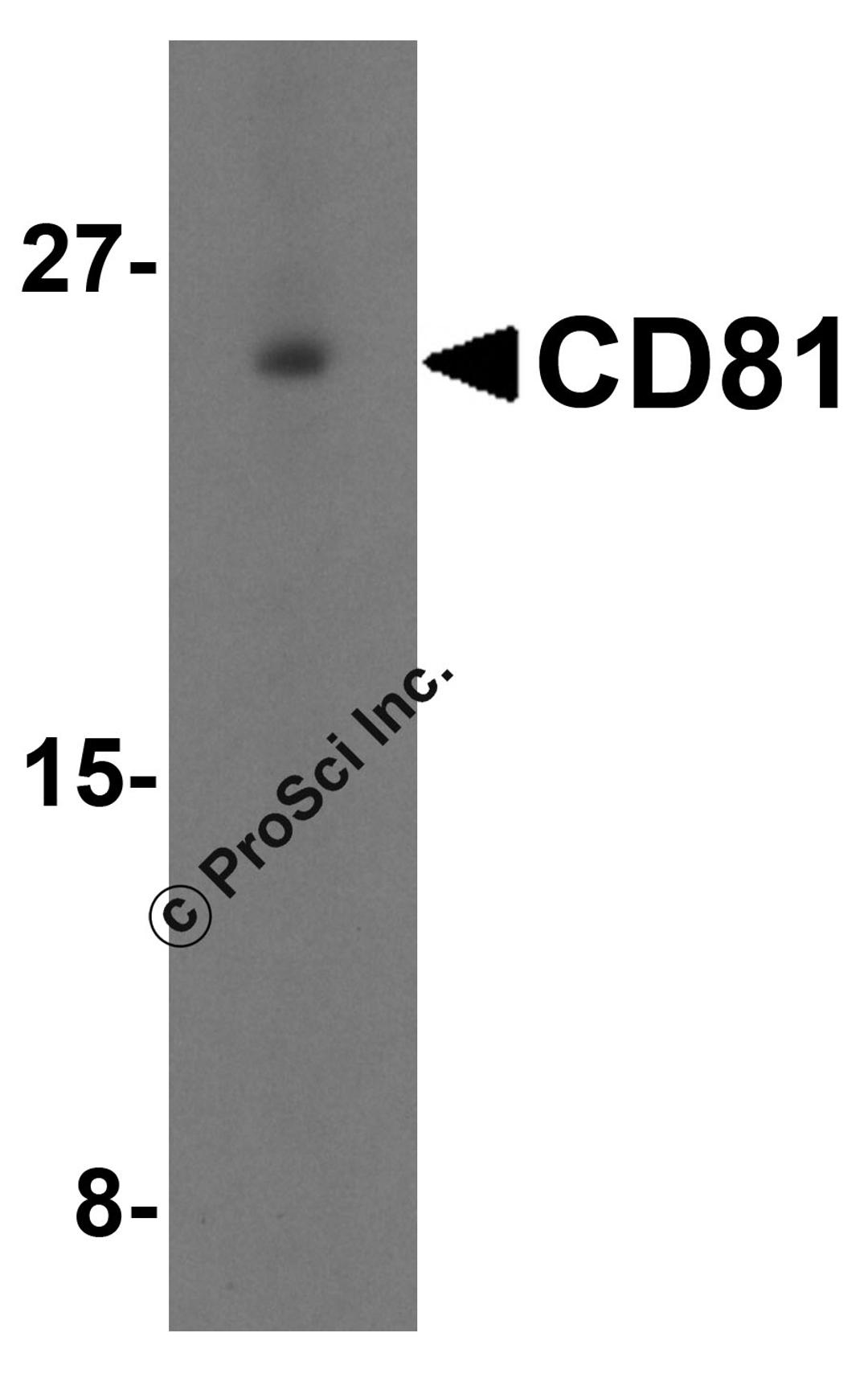 Western blot analysis of CD81 in human lung tissue lysate with CD81 antibody at 1 μg/mL in (A) the absence and (B) the presence of blocking petide.