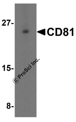 Western blot analysis of CD81 in human lung tissue lysate with CD81 antibody at 1 μg/mL in (A) the absence and (B) the presence of blocking petide.