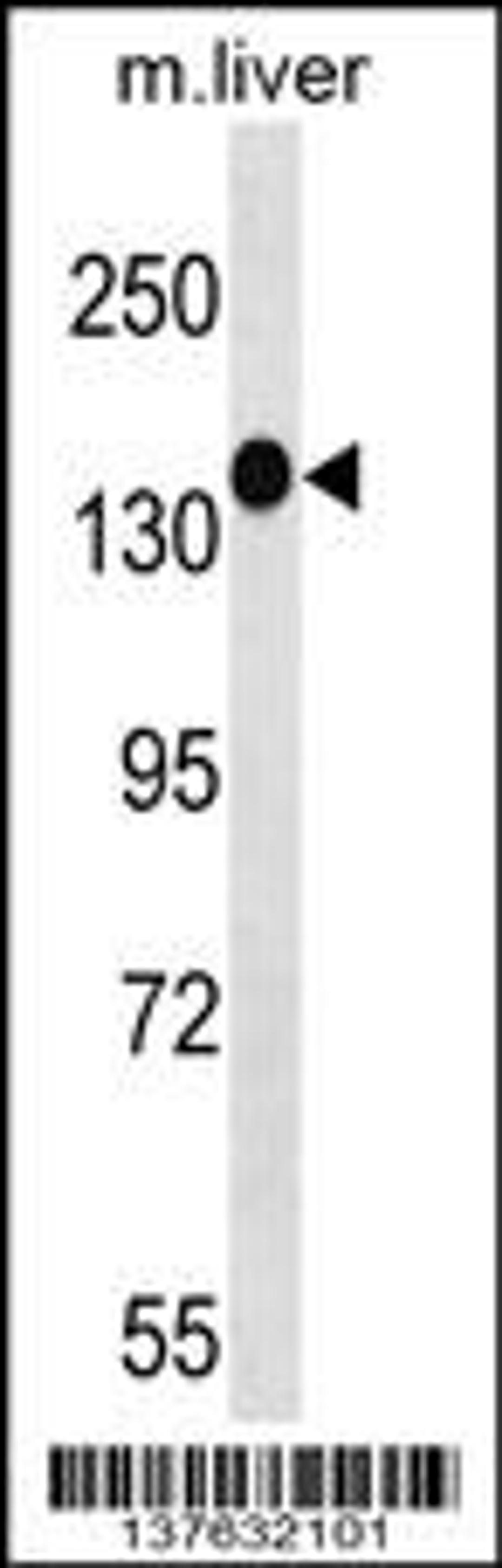 Western blot analysis in mouse liver tissue lysates (35ug/lane).