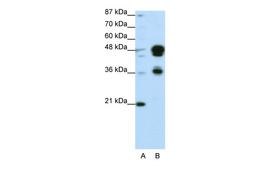 Antibody used in WB on Transfected 293T at 0.2-1 ug/ml.