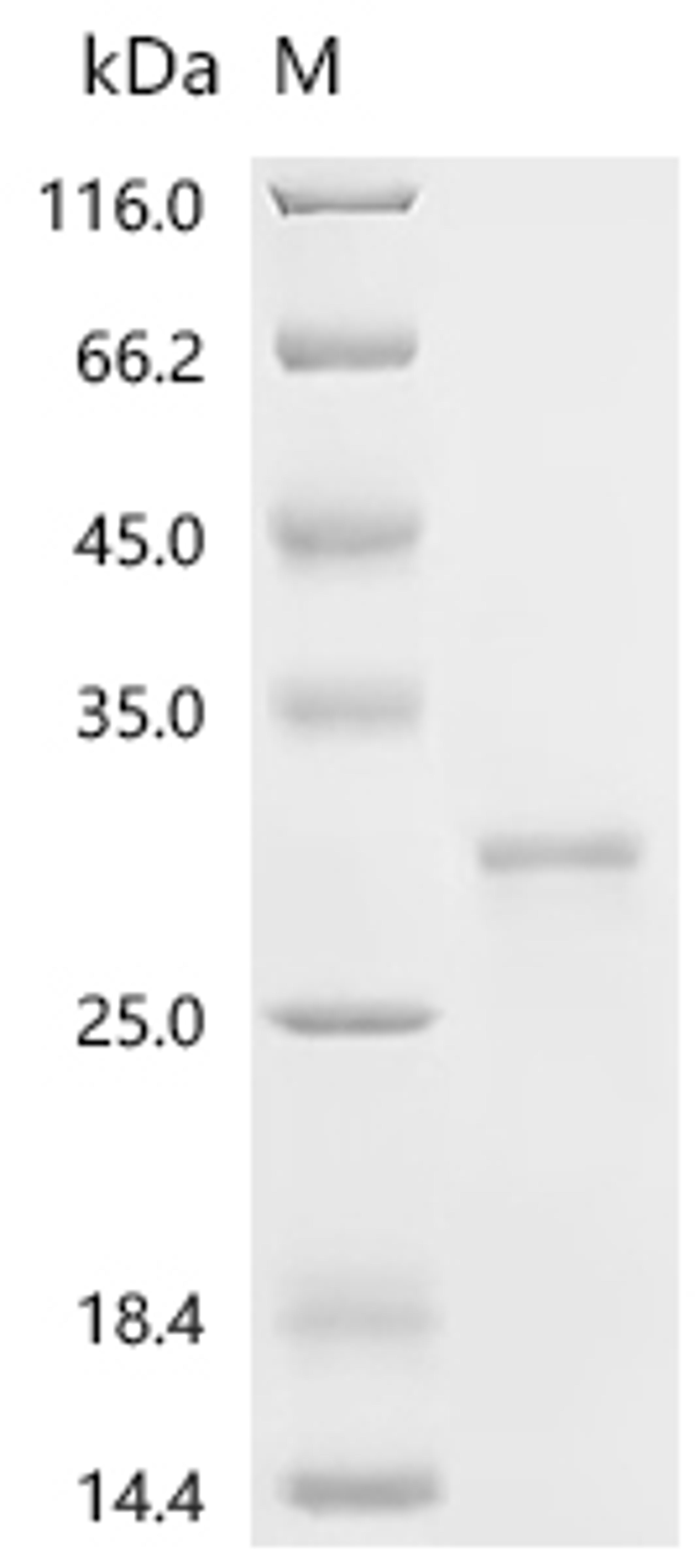 (Tris-Glycine gel) Discontinuous SDS-PAGE (reduced) with 5% enrichment gel and 15% separation gel.