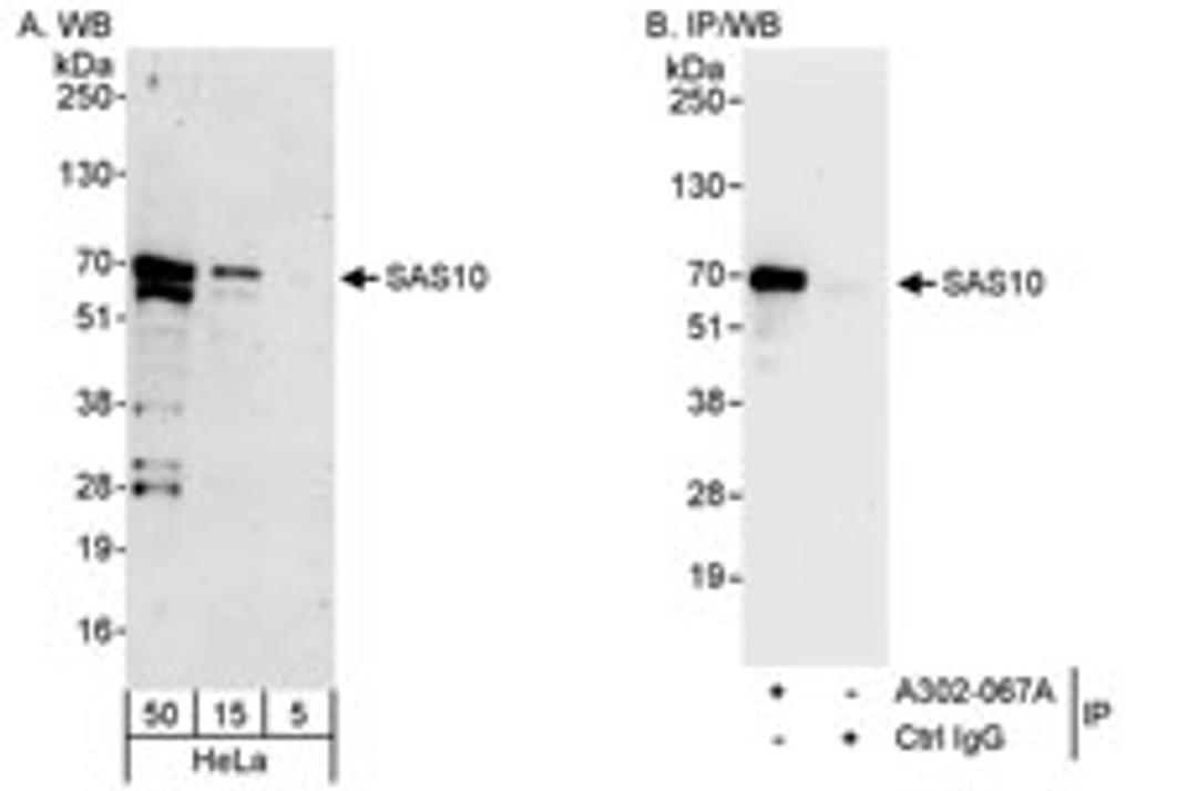 Detection of human SAS10 by western blot and immunoprecipitation.