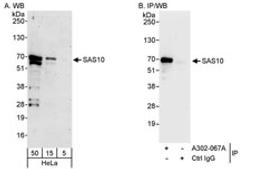 Detection of human SAS10 by western blot and immunoprecipitation.