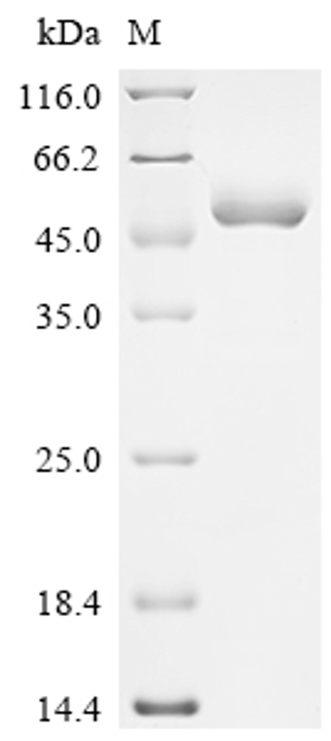 (Tris-Glycine gel) Discontinuous SDS-PAGE (reduced) with 5% enrichment gel and 15% separation gel.
