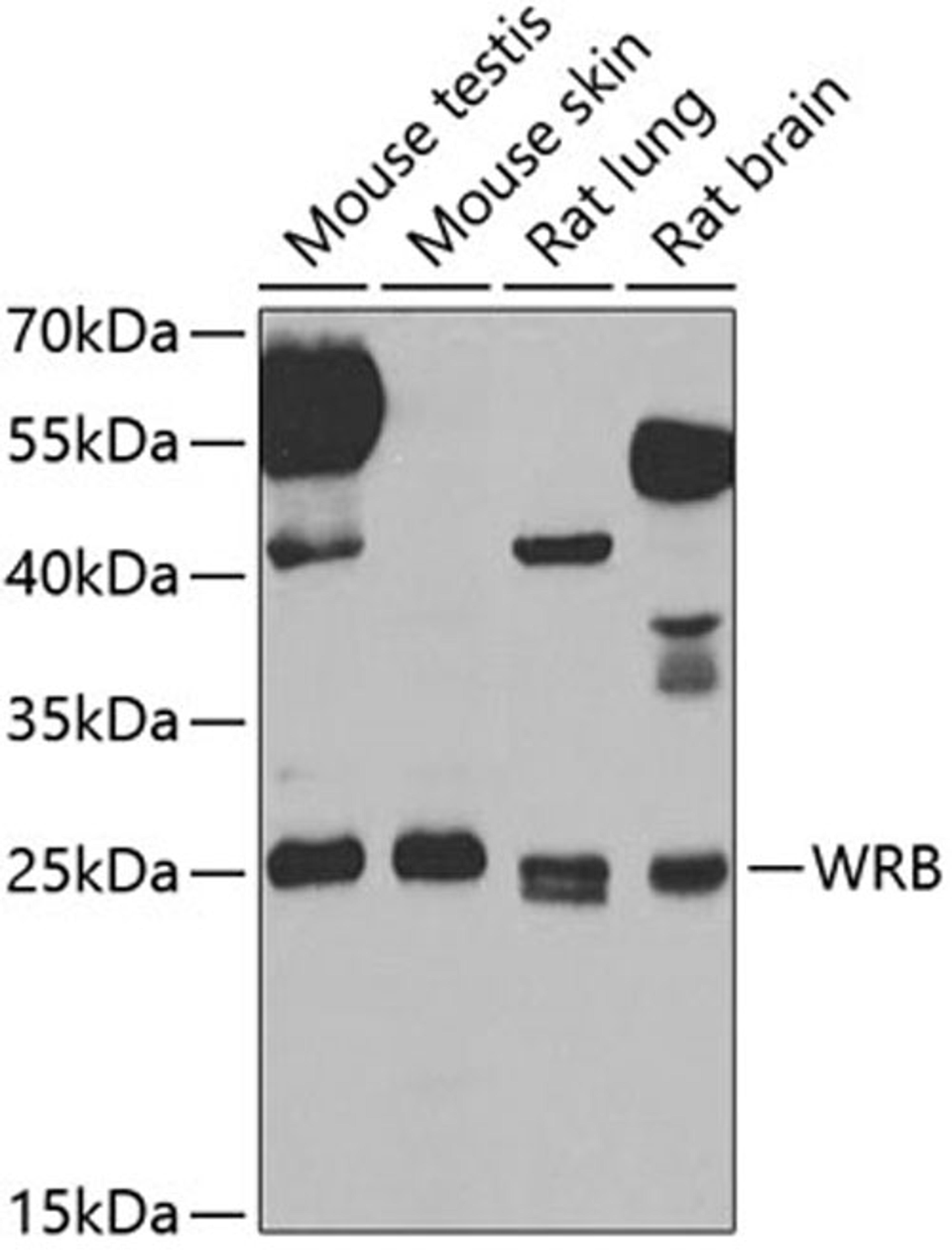 Western blot - WRB antibody (A7000)