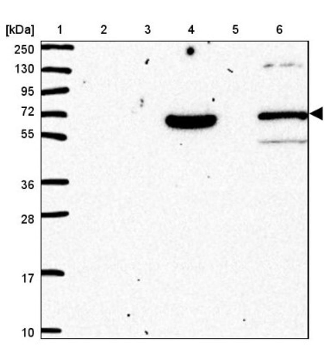 Western Blot: PLEKHA4 Antibody [NBP2-47331] - Lane 1: Marker [kDa] 250, 130, 95, 72, 55, 36, 28, 17, 10.  Lane 2: Human cell line RT-4.  Lane 3: Human cell line U-251MG.  Lane 4: Human plasma (IgG/HSA depleted).  Lane 5: Human liver tissue.  Lane 6: Human tonsil tissue.