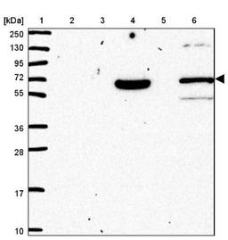 Western Blot: PLEKHA4 Antibody [NBP2-47331] - Lane 1: Marker [kDa] 250, 130, 95, 72, 55, 36, 28, 17, 10.  Lane 2: Human cell line RT-4.  Lane 3: Human cell line U-251MG.  Lane 4: Human plasma (IgG/HSA depleted).  Lane 5: Human liver tissue.  Lane 6: Human tonsil tissue.