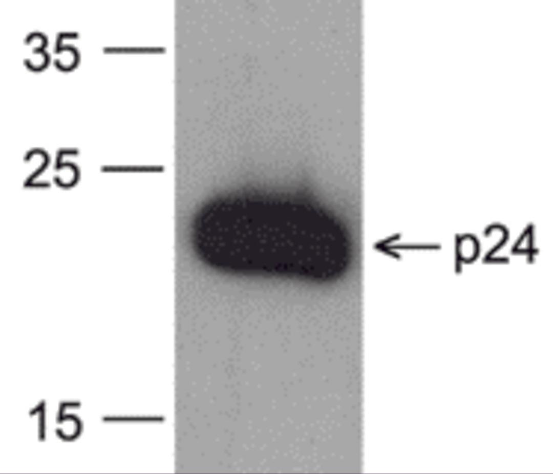 Western blot analysis of 20 ng of recombinant HIV-1 p24 protein with PM-6335-biotin at 0.2 μg/mL.