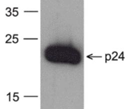 Western blot analysis of 20 ng of recombinant HIV-1 p24 protein with PM-6335-biotin at 0.2 μg/mL.