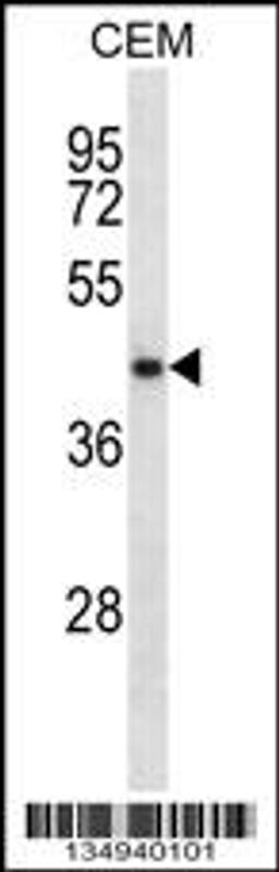 Western blot analysis in CEM cell line lysates (35ug/lane).