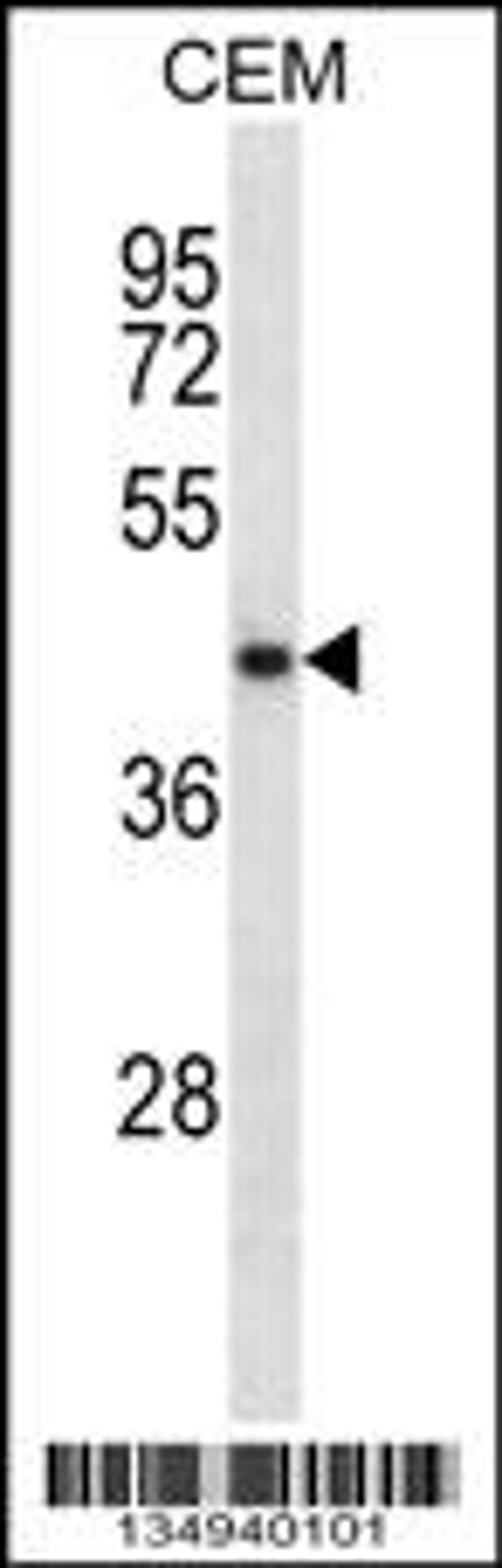 Western blot analysis in CEM cell line lysates (35ug/lane).