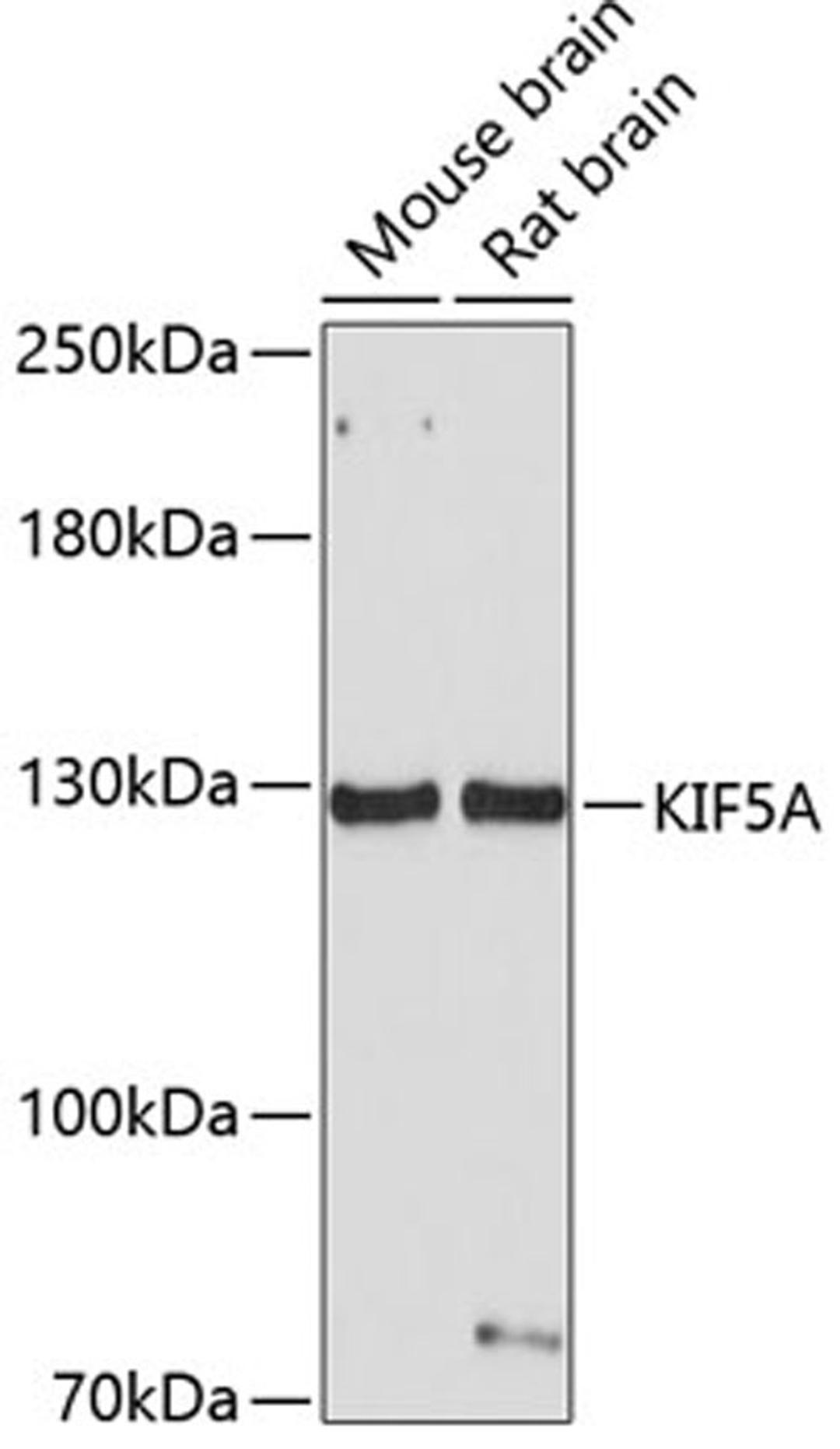 Western blot - KIF5A antibody (A3303)