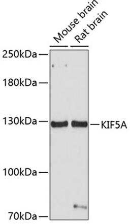 Western blot - KIF5A antibody (A3303)
