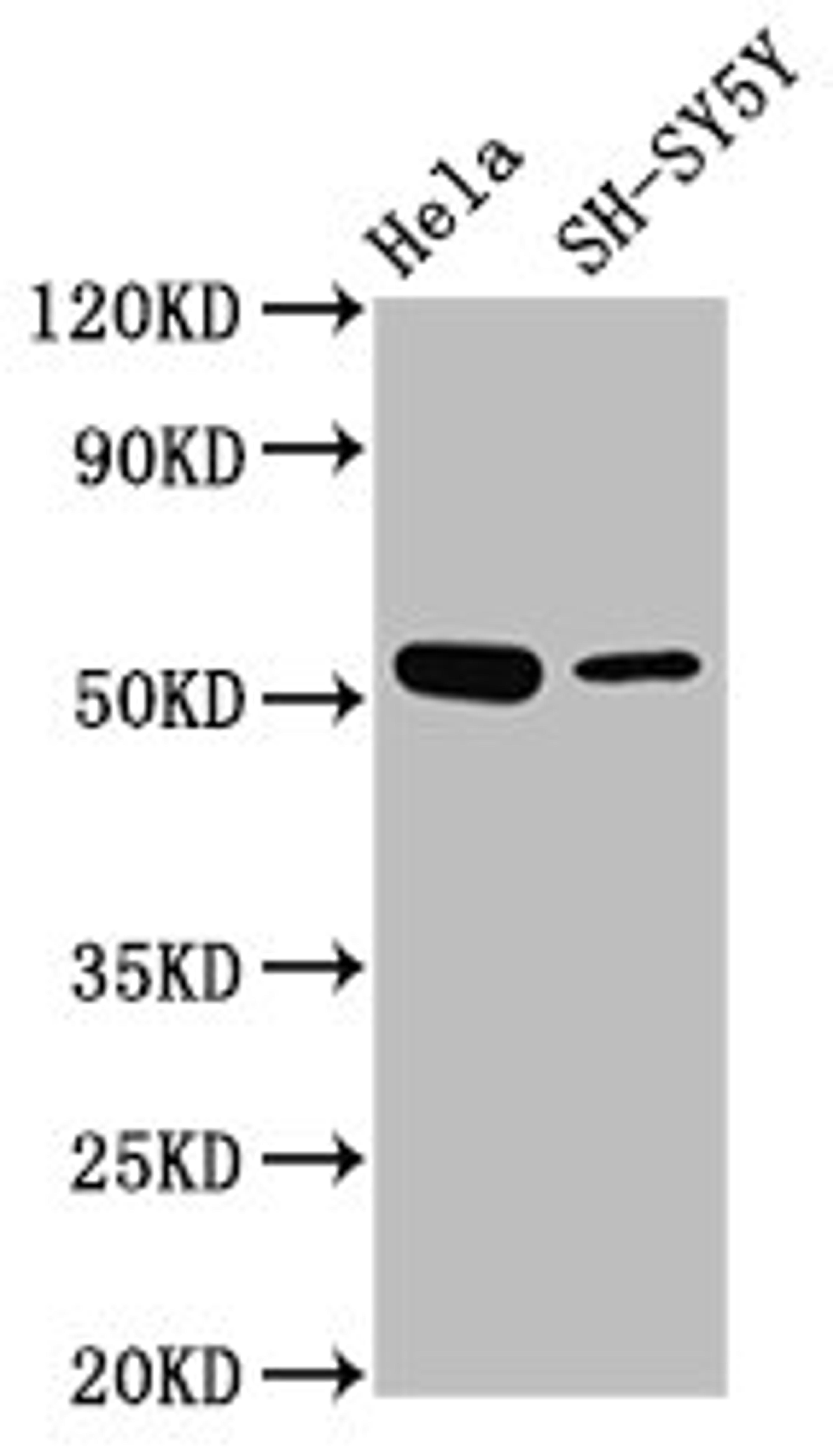 Western Blot. Positive WB detected in: Hela whole cell lysate, SH-SY5Y whole cell lysate. All lanes: MEX3A antibody at 4.3µg/ml. Secondary. Goat polyclonal to rabbit IgG at 1/50000 dilution. Predicted band size: 55 kDa. Observed band size: 55 kDa