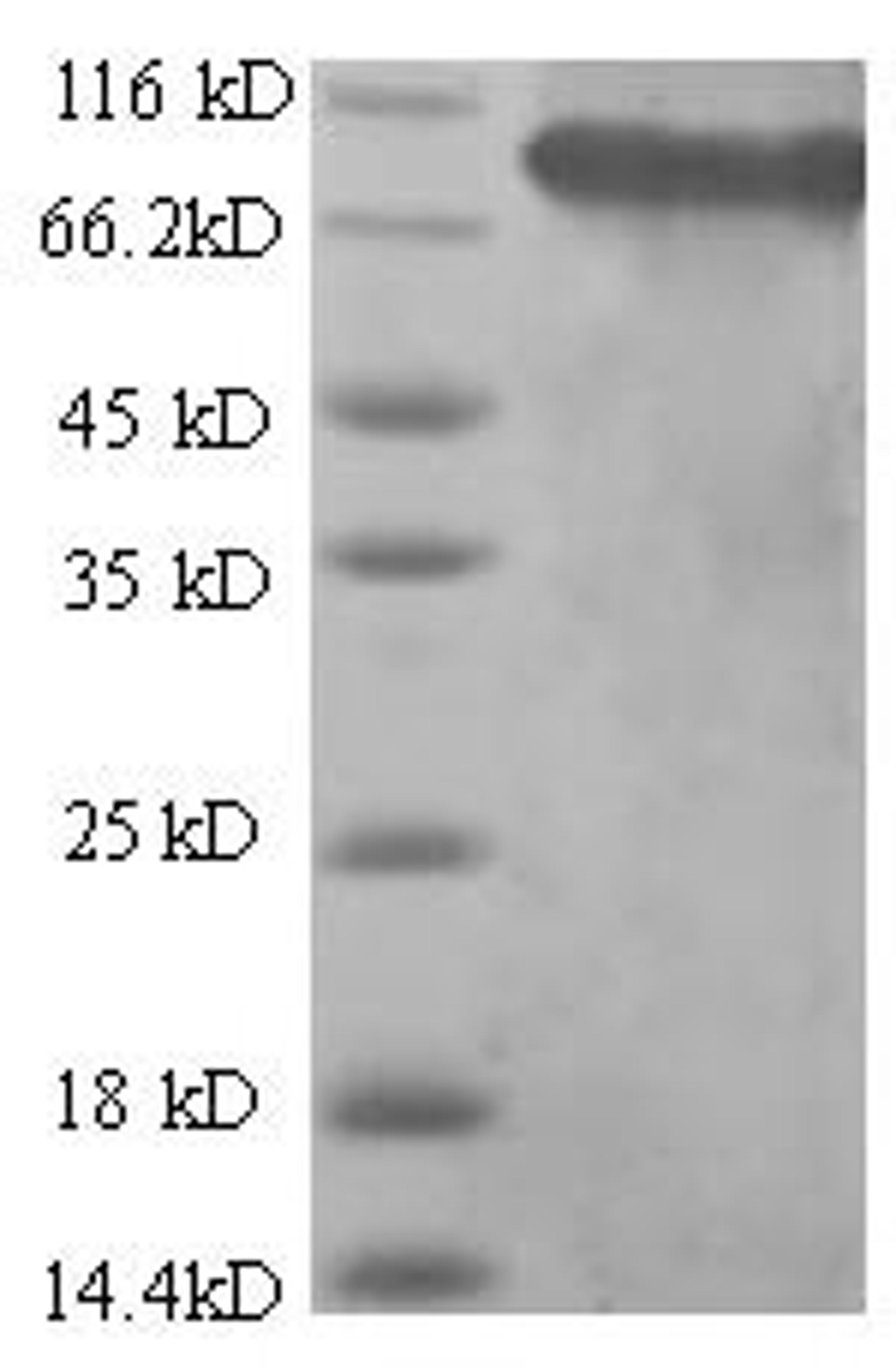 (Tris-Glycine gel) Discontinuous SDS-PAGE (reduced) with 5% enrichment gel and 15% separation gel.