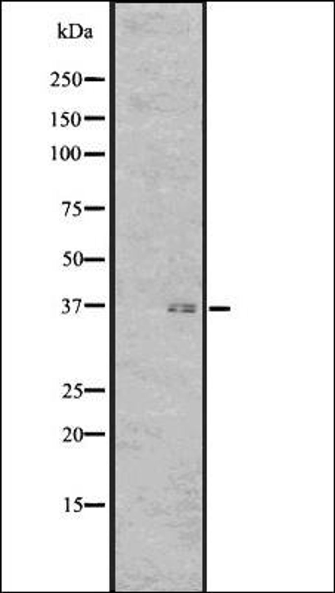 Western blot analysis of Human fetal brain lysate using GPR7 antibody