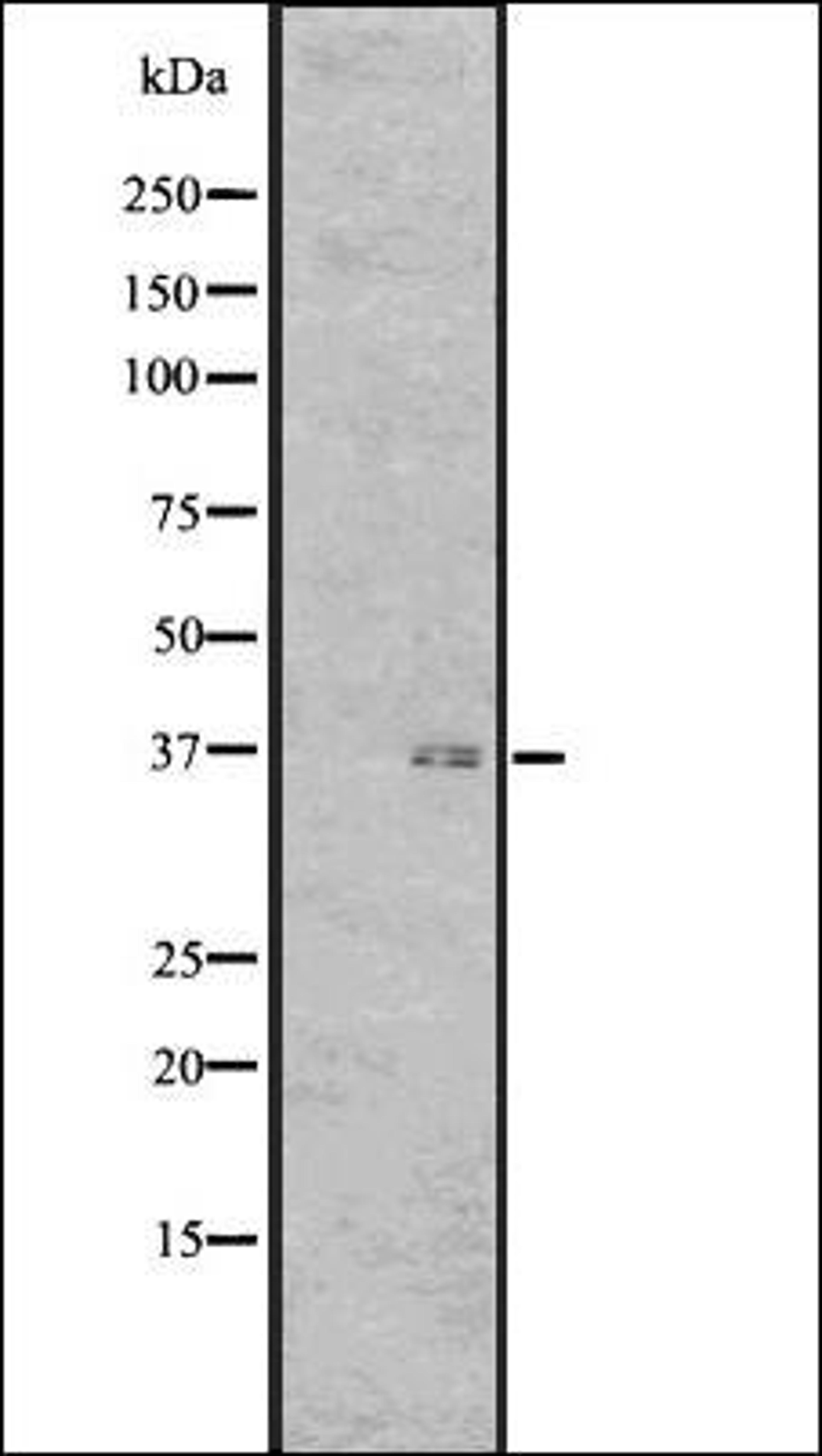 Western blot analysis of Human fetal brain lysate using GPR7 antibody