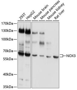 Western blot - NOX3 antibody (A3677)
