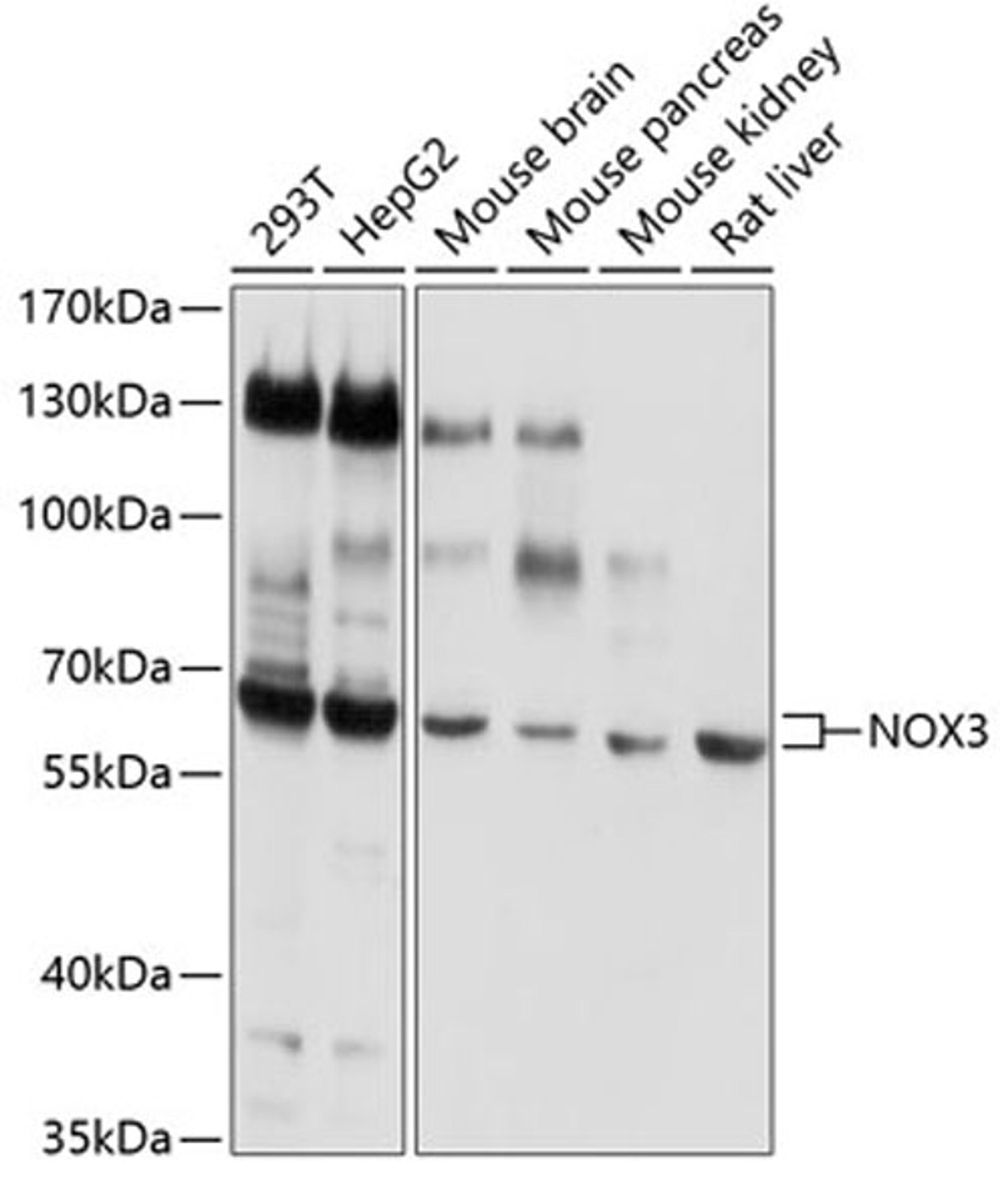 Western blot - NOX3 antibody (A3677)