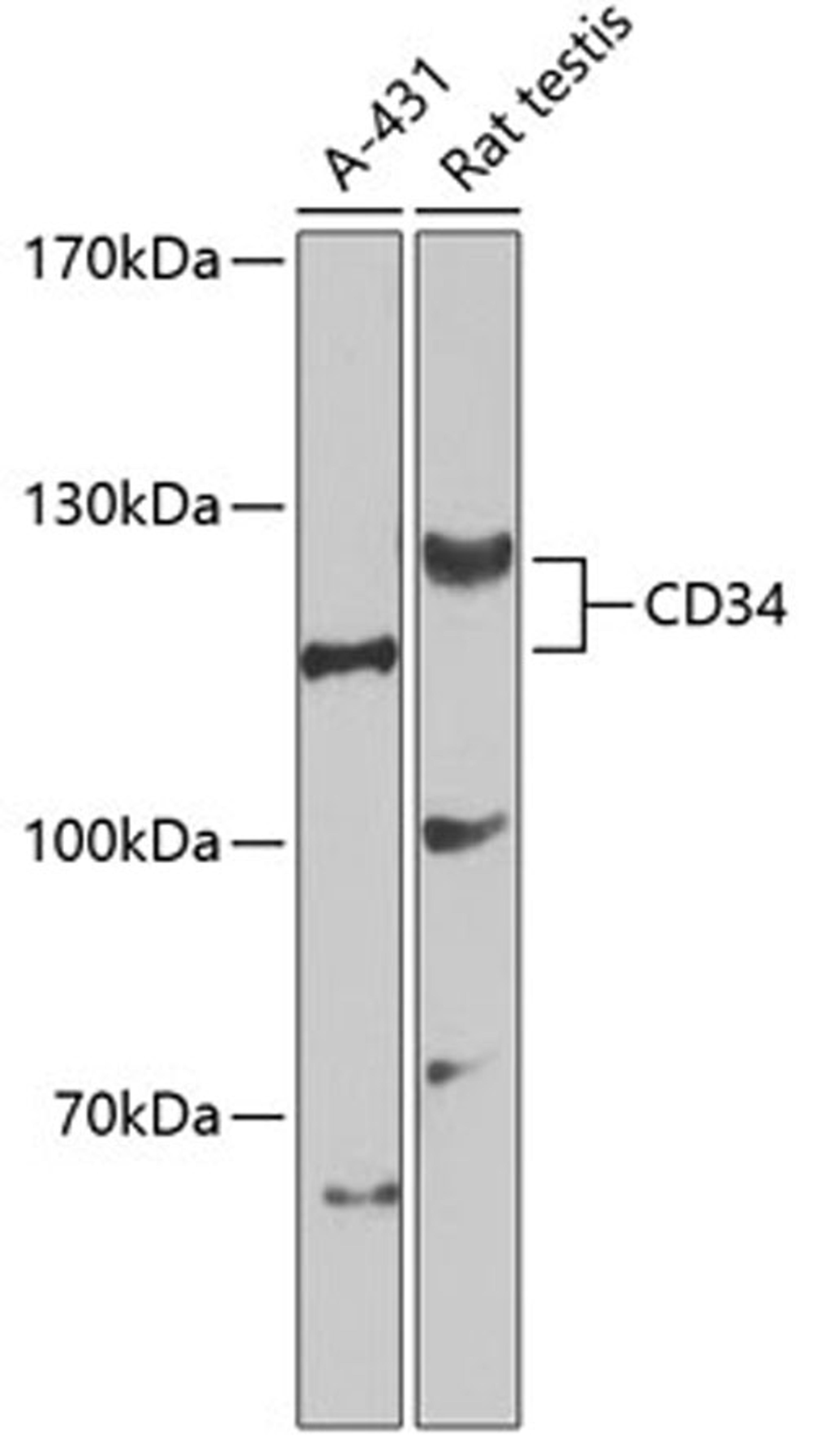 Western blot - CD34 Antibody (A0761)