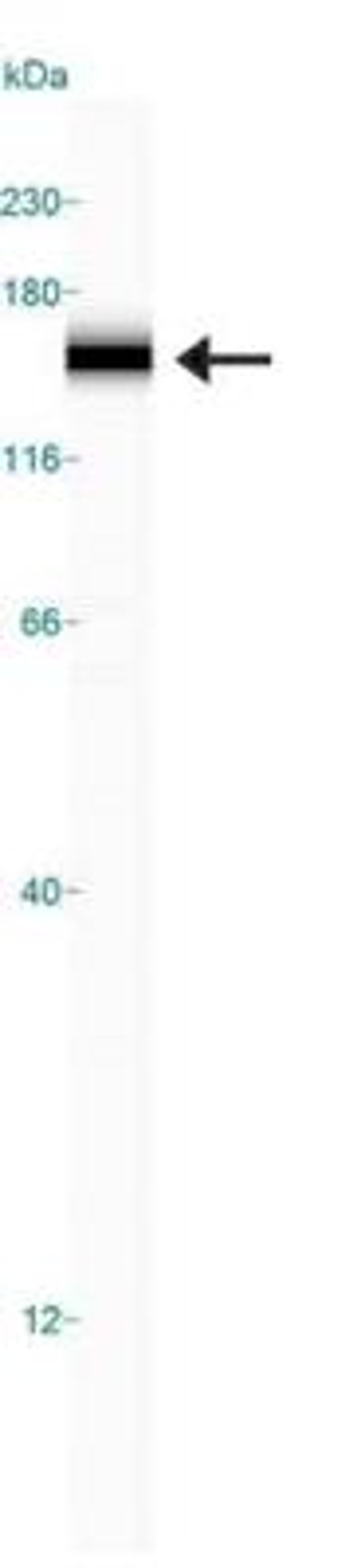 Simple Western: Rad50 Antibody [NB100-154] - Simple Western lane view shows a specific band for Rad50 in 0.5 mg/ml of HeLa lysate.  This experiment was performed under reducing conditions using the 12-230 kDa separation system.