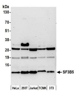 Detection of human and mouse SF3B5 by WB.