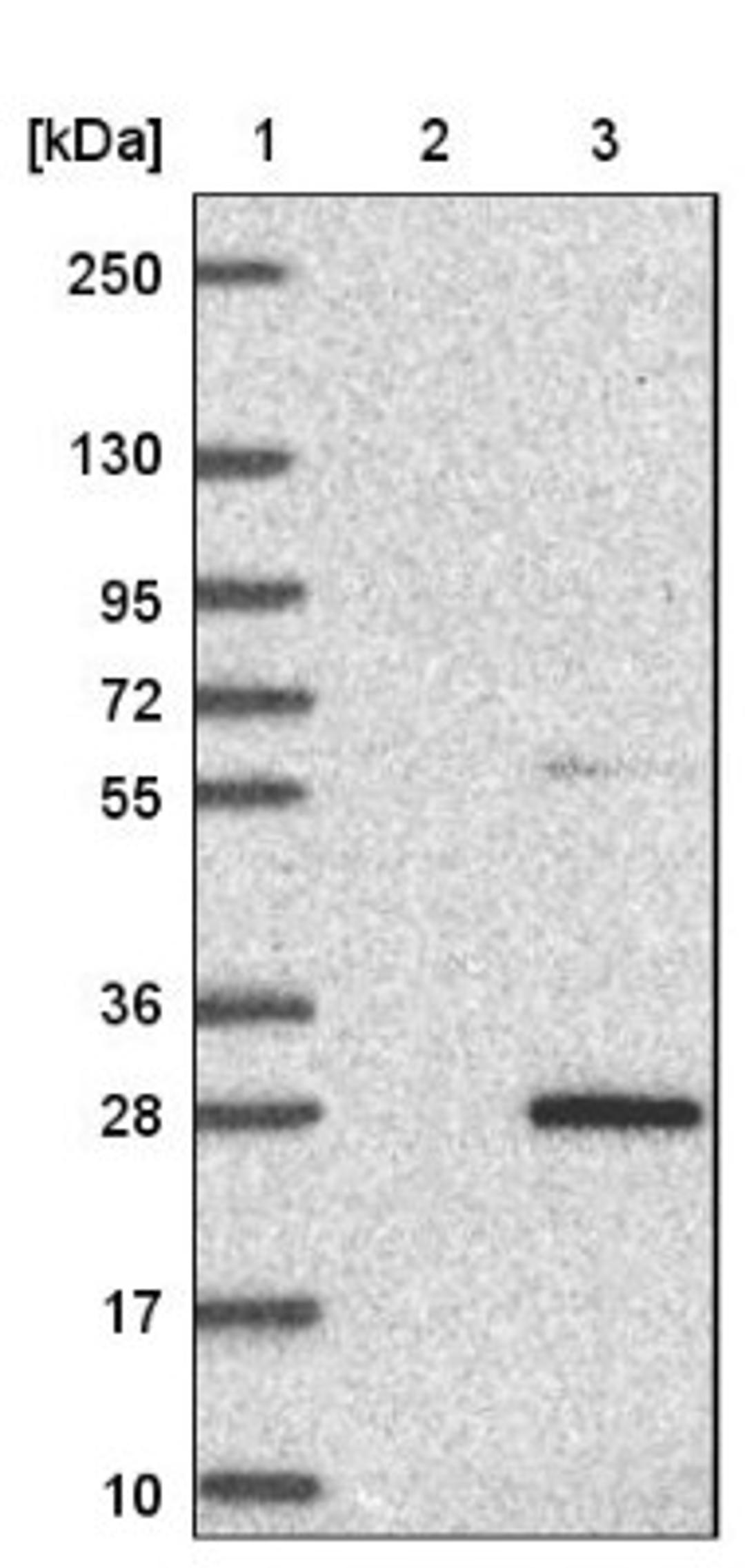 Western Blot: PRR13 Antibody [NBP1-92299] - Lane 1: Marker [kDa] 250, 130, 95, 72, 55, 36, 28, 17, 10<br/>Lane 2: Negative control (vector only transfected HEK293T lysate)<br/>Lane 3: Over-expression lysate (Co-expressed with a C-terminal myc-DDK tag (~3.1 kDa) in mammalian HEK293T cells, LY413037)