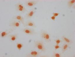 Immunocytochemistry analysis of CSB-PA010377OA66forHU diluted at 1:10 and staining in Hela cells(treated with 30mM sodium butyrate for 4h) performed on a Leica BondTM system. The cells were fixed in 4% formaldehyde, permeabilized using 0.2% Triton X-100 and blocked with 10% normal goat serum 30min at RT. Then primary antibody (1% BSA) was incubated at 4°C overnight. The primary is detected by a biotinylated secondary antibody and visualized using an HRP conjugated SP system.