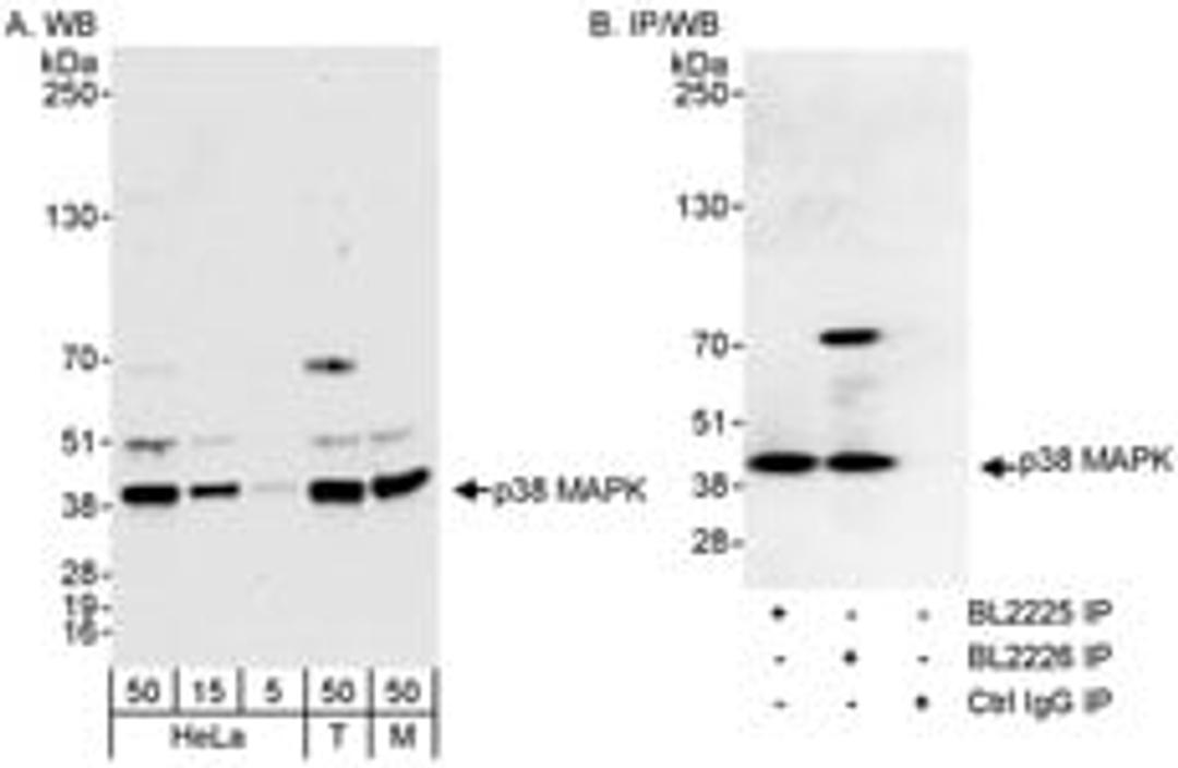 Detection of human and mouse p38 MAPK by western blot (h&m) and immunoprecipitation (h).