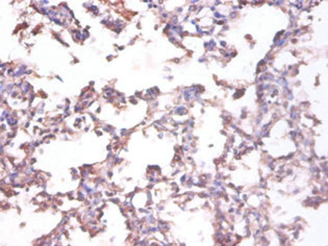 Immunohistochemistry of paraffin-embedded human lung tissue using CSB-PA07475A0Rb at dilution of 1:100