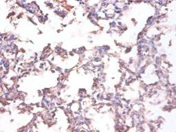 Immunohistochemistry of paraffin-embedded human lung tissue using CSB-PA07475A0Rb at dilution of 1:100