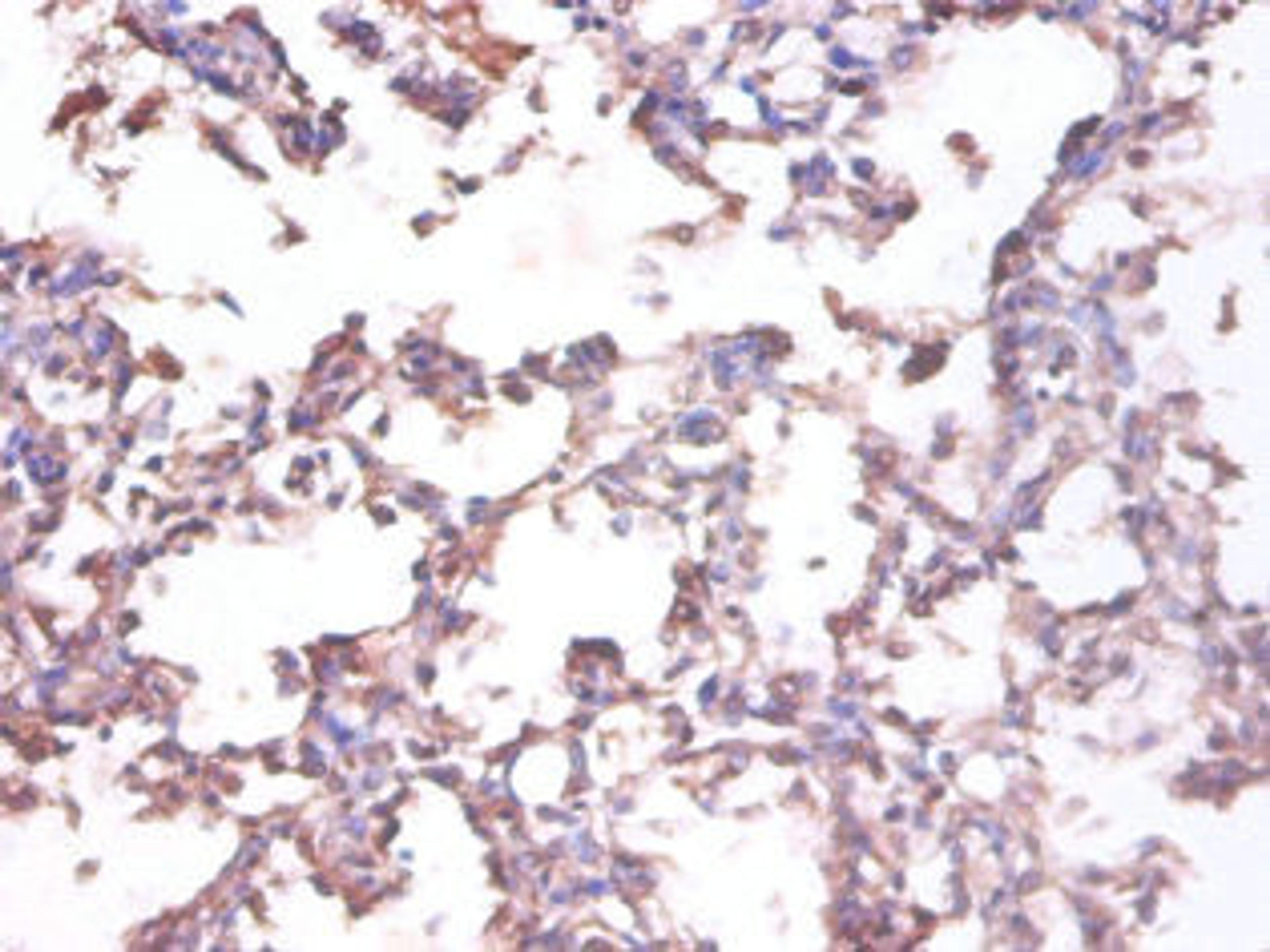 Immunohistochemistry of paraffin-embedded human lung tissue using CSB-PA07475A0Rb at dilution of 1:100