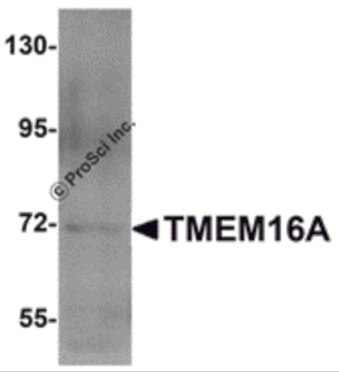 Western blot analysis of TMEM16A in A549 cell lysate with TMEM16A antibody at 1 &#956;g/mL.