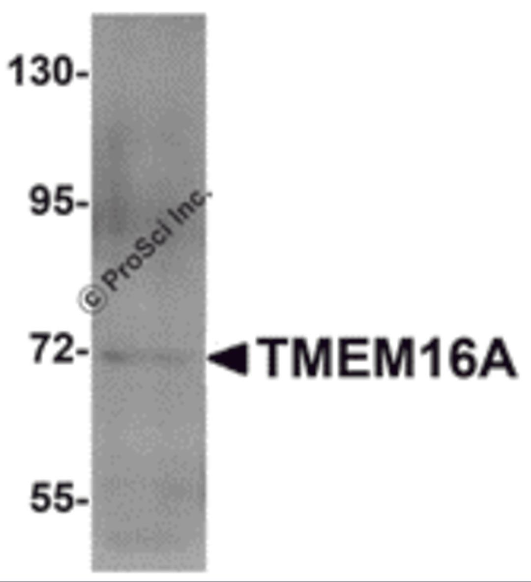 Western blot analysis of TMEM16A in A549 cell lysate with TMEM16A antibody at 1 μg/mL.