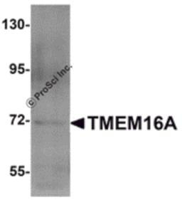 Western blot analysis of TMEM16A in A549 cell lysate with TMEM16A antibody at 1 μg/mL.