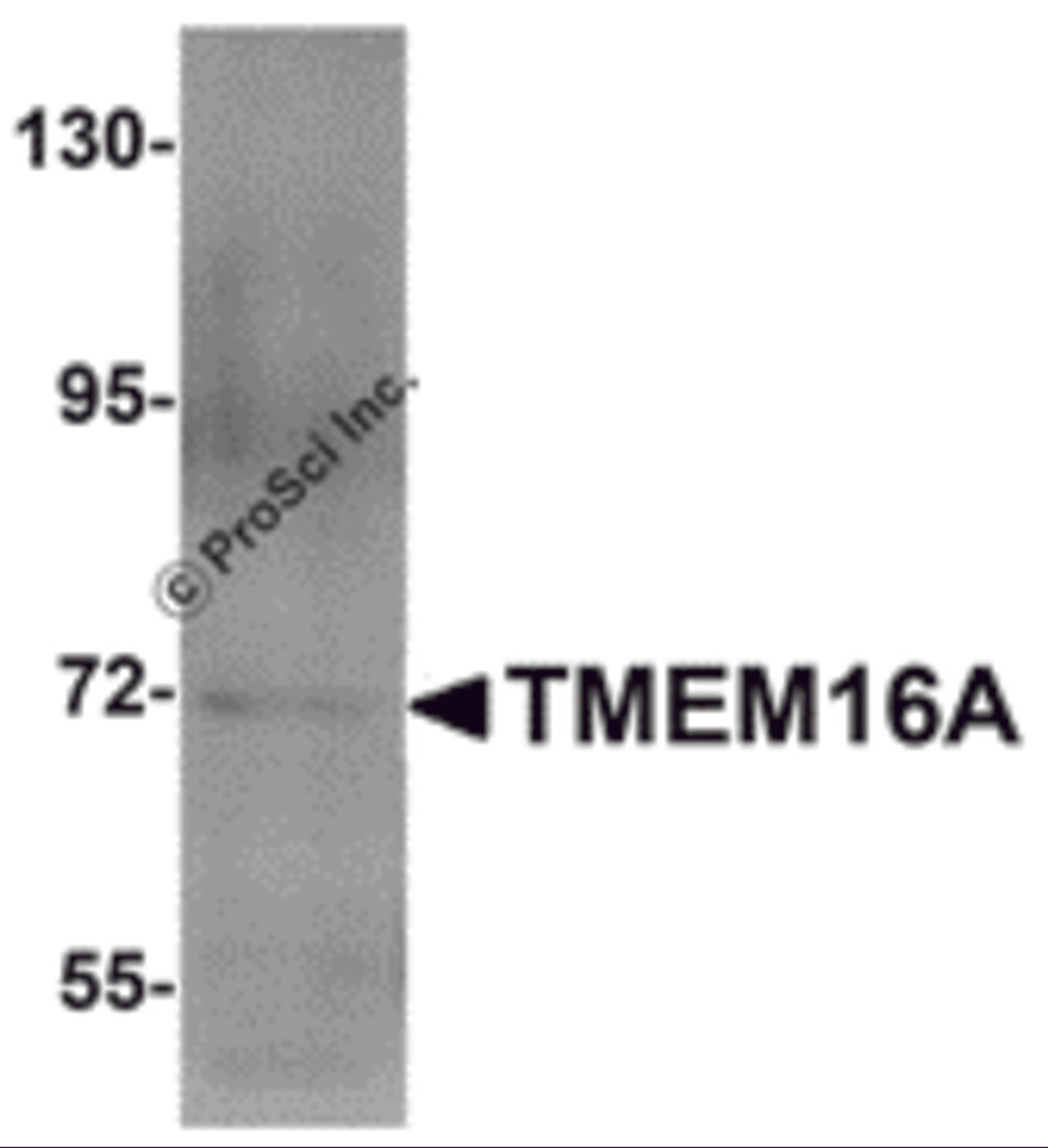 Western blot analysis of TMEM16A in A549 cell lysate with TMEM16A antibody at 1 μg/mL.