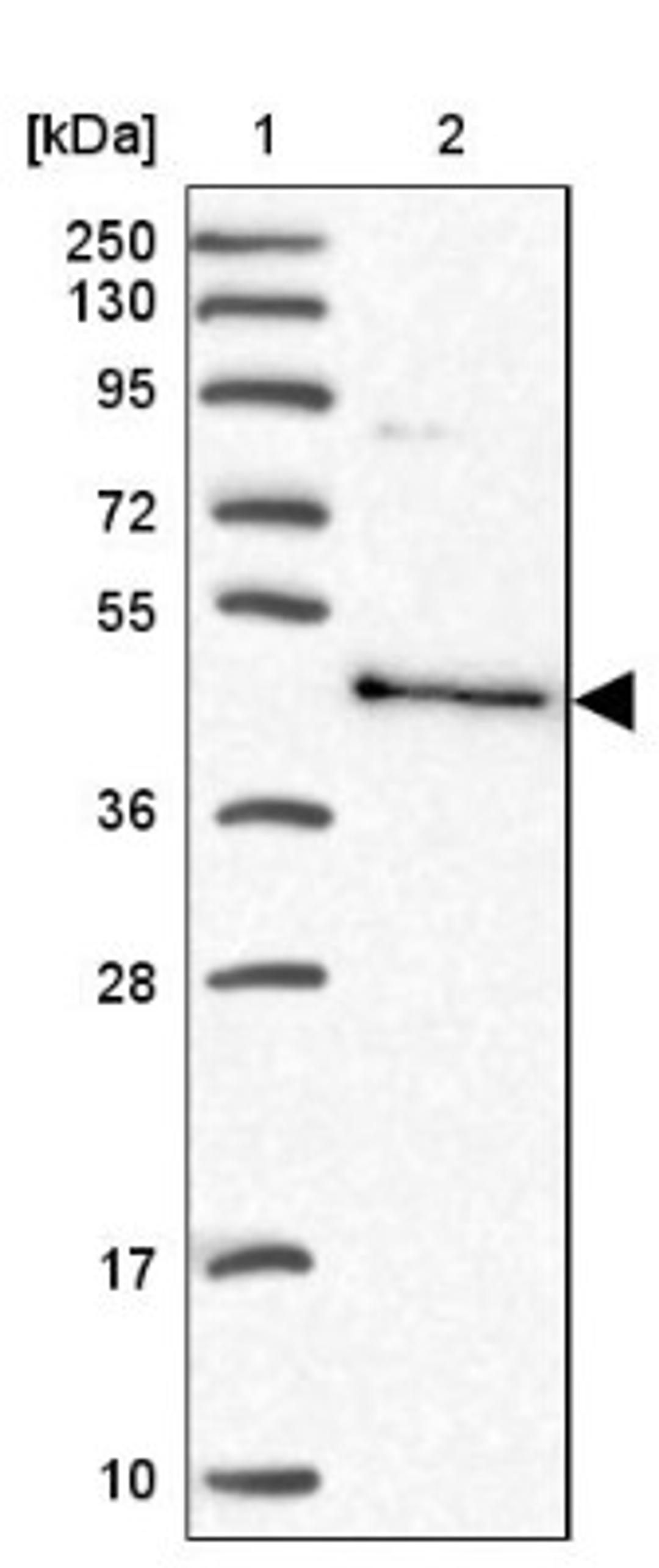 Western Blot: BSPRY Antibody [NBP1-82204] - Lane 1: Marker [kDa] 250, 130, 95, 72, 55, 36, 28, 17, 10<br/>Lane 2: Human cell line RT-4