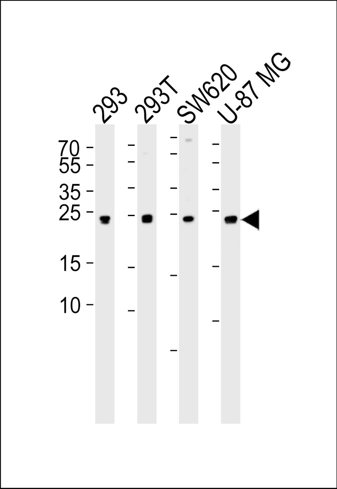 Western blot analysis of lysates from 293, 293T, SW620, U-87 MG cell line (from left to right), using UCHL3 Antibody (C209) at 1:1000 at each lane.